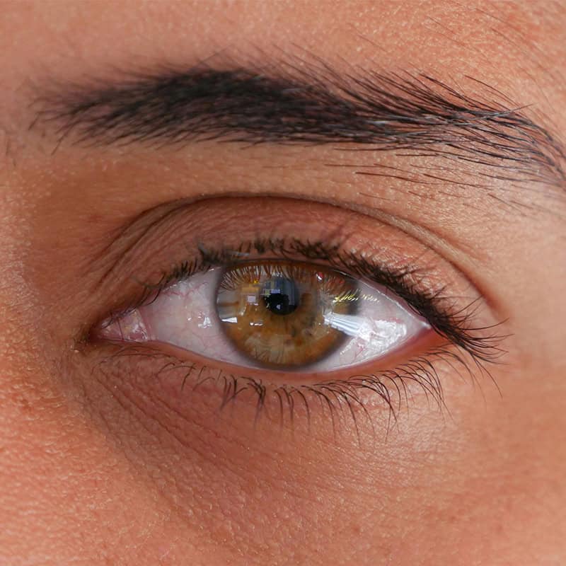 EMDR Therapy- Service Page